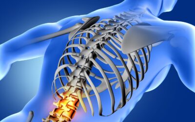 Sai quali sono le cause e le terapie efficaci per la lombalgia cronica?